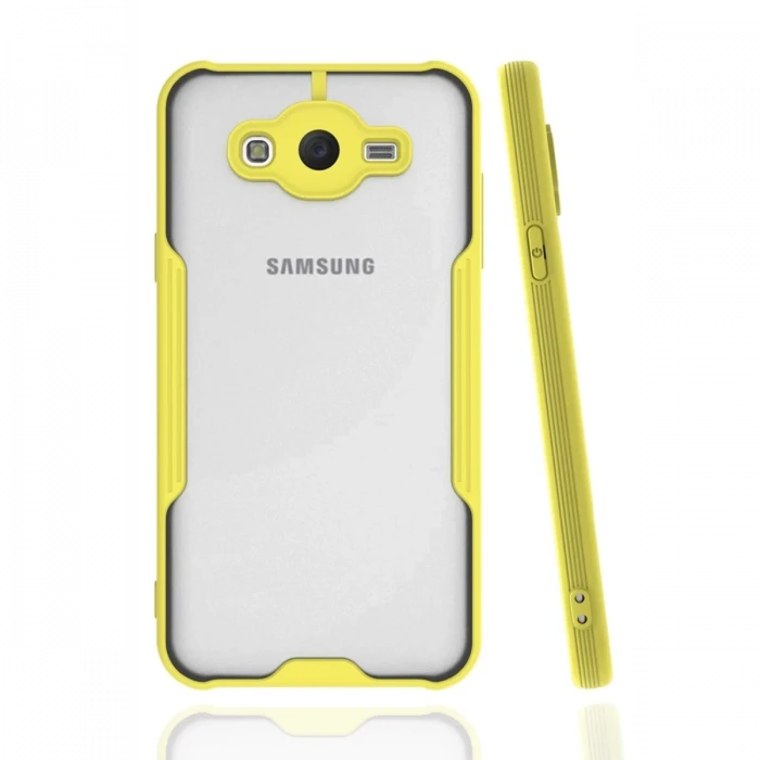 Newface Samsung Galaxy J7 Kılıf Platin Silikon - Sarı
