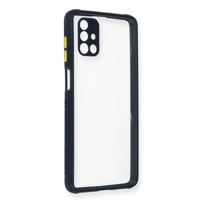 Newface Samsung Galaxy M51 Kılıf Miami Şeffaf Silikon - Lacivert