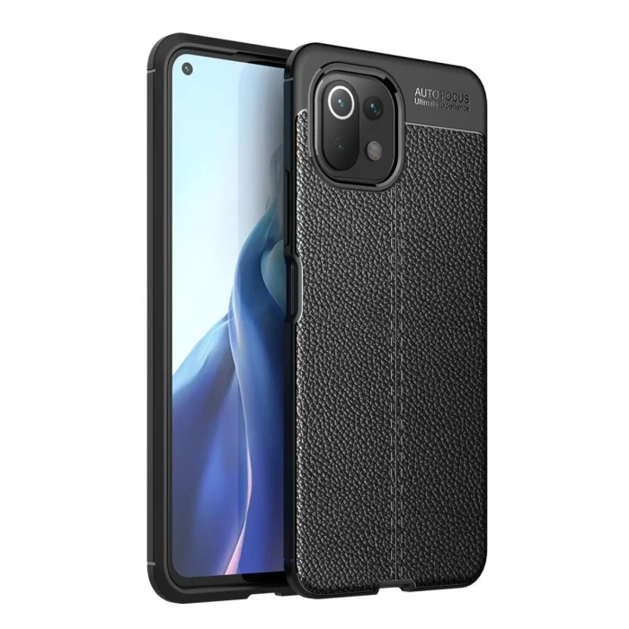 Newface Xiaomi Mİ 11 Lite Kılıf Auto Focus Kapak - Siyah
