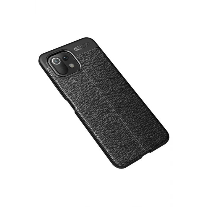 Newface Xiaomi Mİ 11 Lite Kılıf Auto Focus Kapak - Siyah