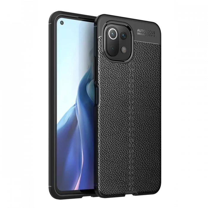 Newface Xiaomi Mİ 11 Lite Kılıf Auto Focus Kapak - Siyah