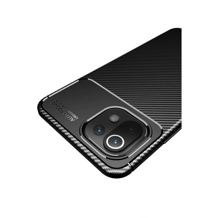 Newface Xiaomi Mİ 11 Lite Kılıf Auto Focus Karbon Kapak - Siyah