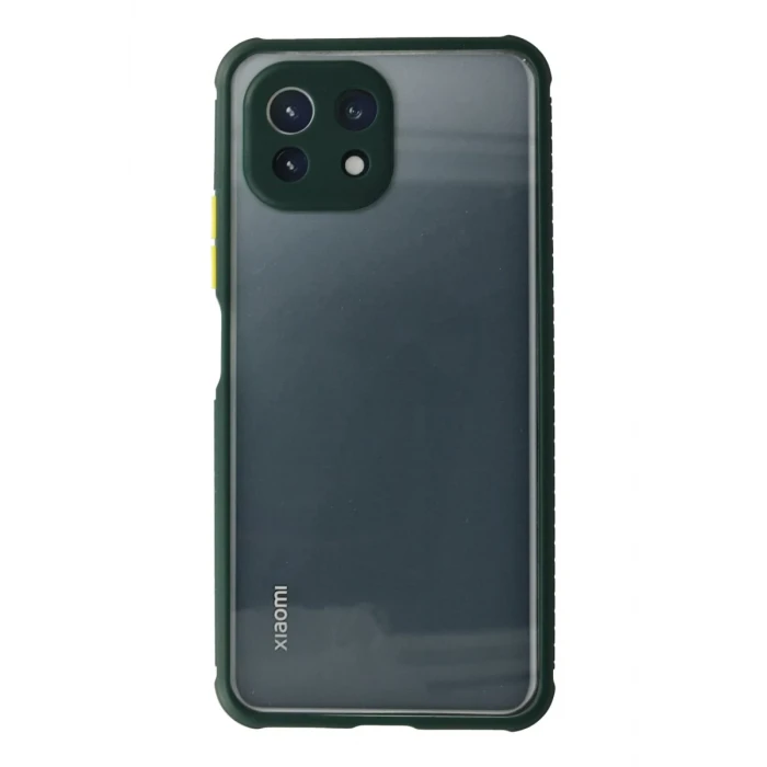Newface Xiaomi Mİ 11 Lite Kılıf Miami Şeffaf Silikon - Koyu Yeşil