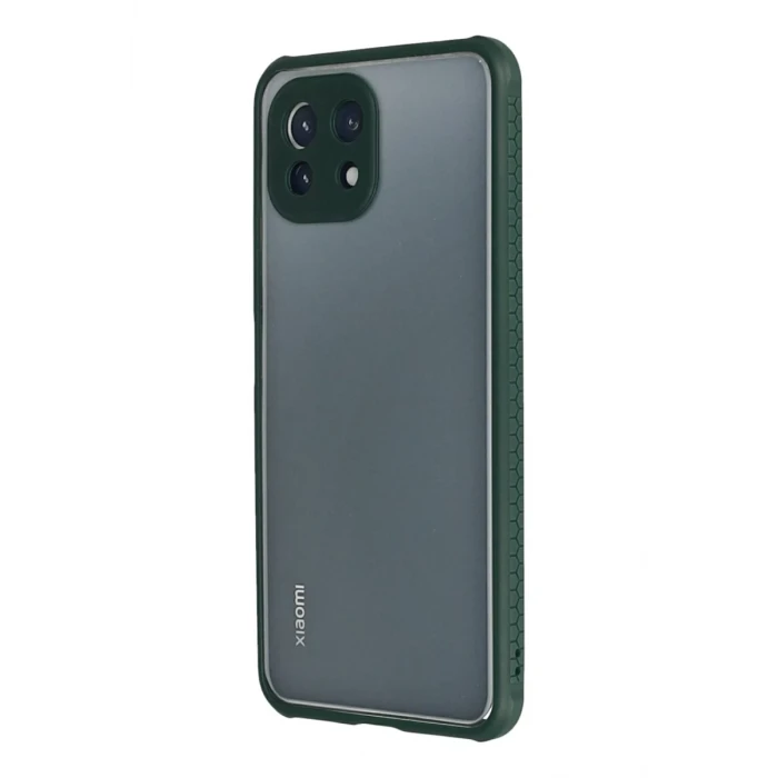 Newface Xiaomi Mİ 11 Lite Kılıf Miami Şeffaf Silikon - Koyu Yeşil
