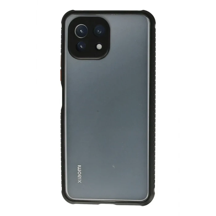Newface Xiaomi Mİ 11 Lite Kılıf Miami Şeffaf Silikon - Siyah