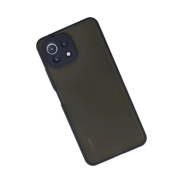 Newface Xiaomi Mİ 11 Lite Kılıf Montreal Silikon Kapak - Lacivert