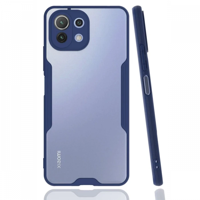Newface Xiaomi Mİ 11 Lite Kılıf Platin Silikon - Lacivert
