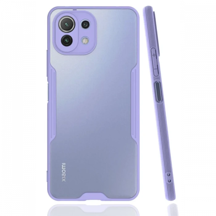 Newface Xiaomi Mİ 11 Lite Kılıf Platin Silikon - Lila