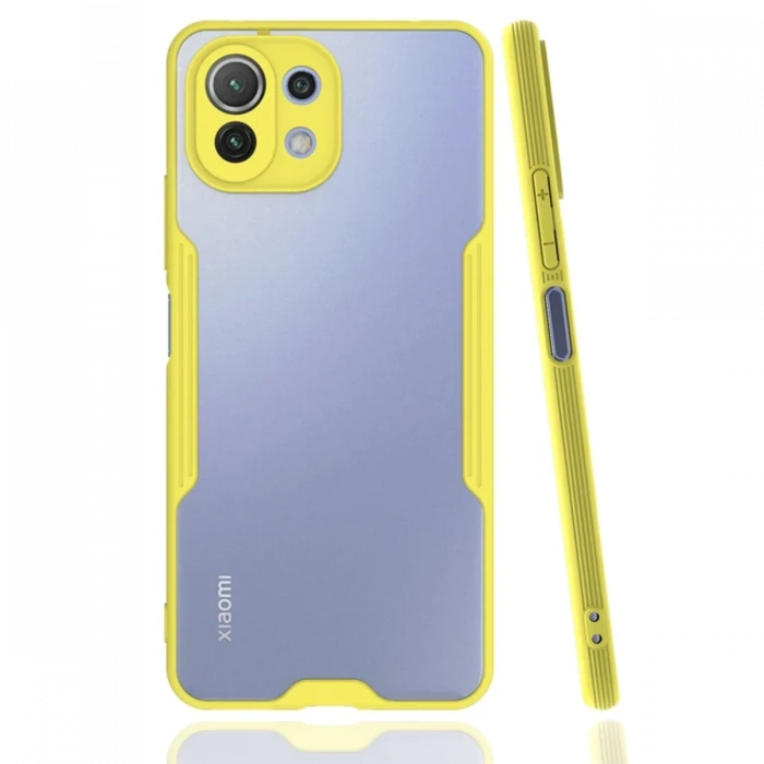 Newface Xiaomi Mİ 11 Lite Kılıf Platin Silikon - Sarı