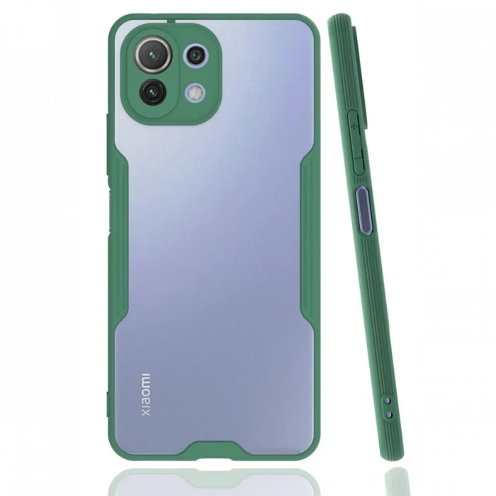 Newface Xiaomi Mİ 11 Lite Kılıf Platin Silikon - Yeşil