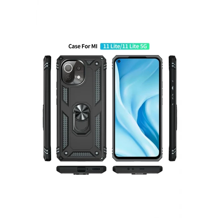 Newface Xiaomi Mİ 11 Lite Kılıf Sofya Yüzüklü Silikon Kapak - Siyah