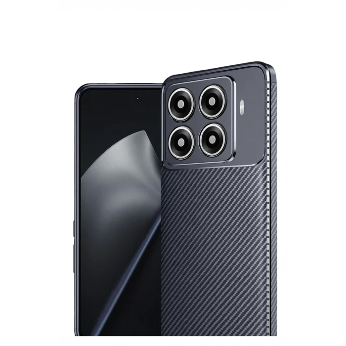 Newface Xiaomi Mi 15T Pro Auto Focus Karbon Kapak - Lacivert