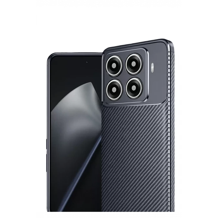 Newface Xiaomi Mi 15T Pro Auto Focus Karbon Kapak - Lacivert