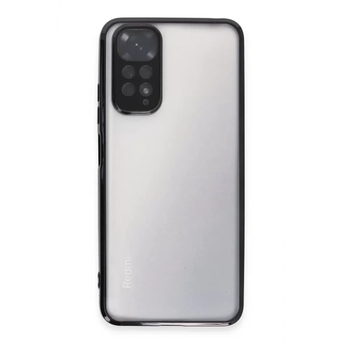 Newface Xiaomi Redmi Note 11 Kılıf Razer Lensli Silikon - Siyah