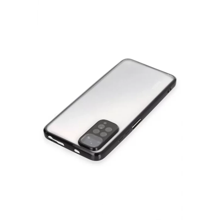 Newface Xiaomi Redmi Note 11 Kılıf Razer Lensli Silikon - Siyah