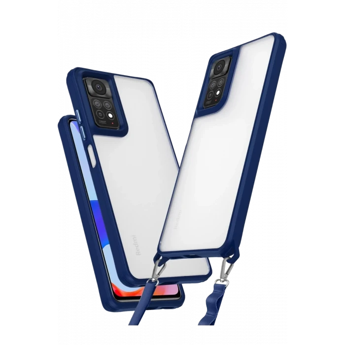 Newface Xiaomi Redmi Note 11 Pro Kılıf Penta Silikon Kılıf - Lacivert