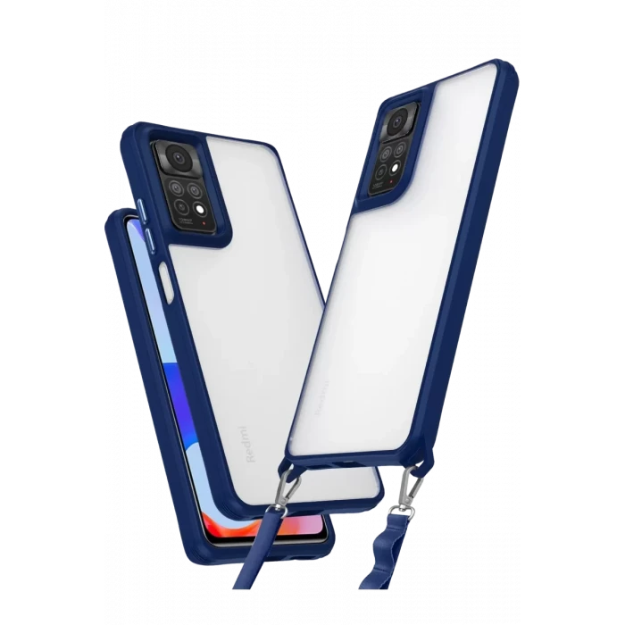Newface Xiaomi Redmi Note 11 Pro Kılıf Penta Silikon Kılıf - Lacivert