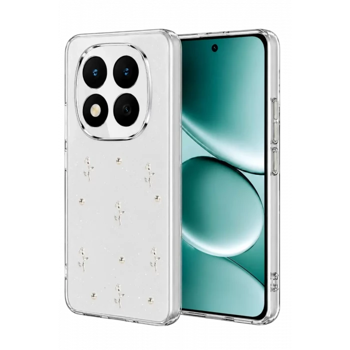 Newface Xiaomi Redmi Note 15 Pro 4G Fiyonk Desenli Kapak - Desen 4
