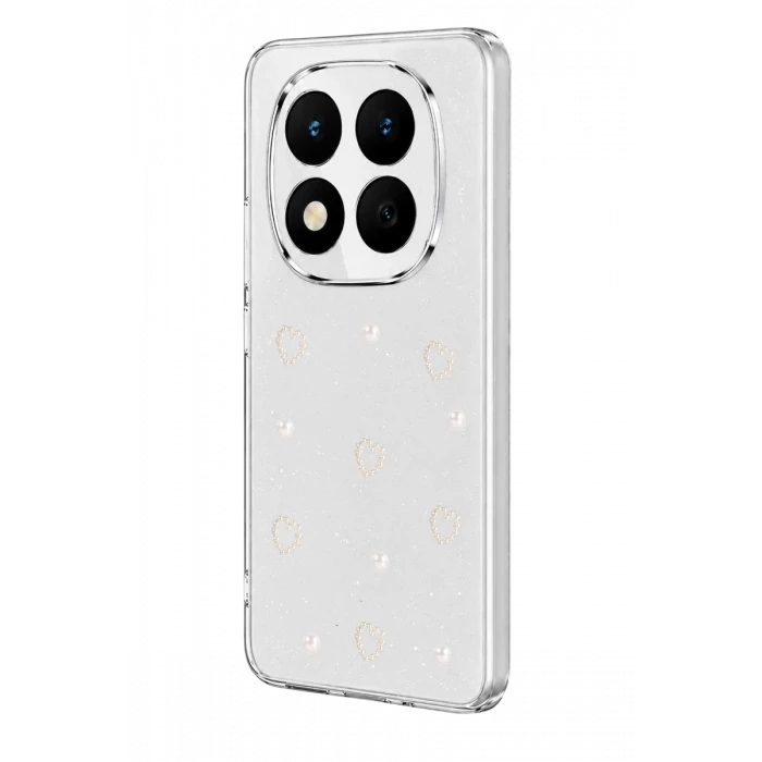 Newface Xiaomi Redmi Note 15 Pro Plus 5G Fiyonk Desenli Kapak - Desen 10