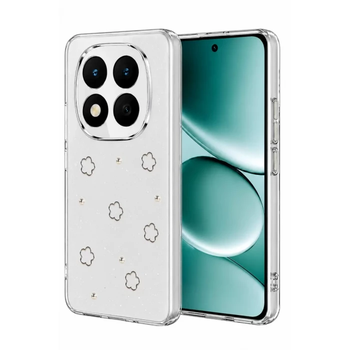 Newface Xiaomi Redmi Note 15 Pro Plus 5G Fiyonk Desenli Kapak - Desen 2