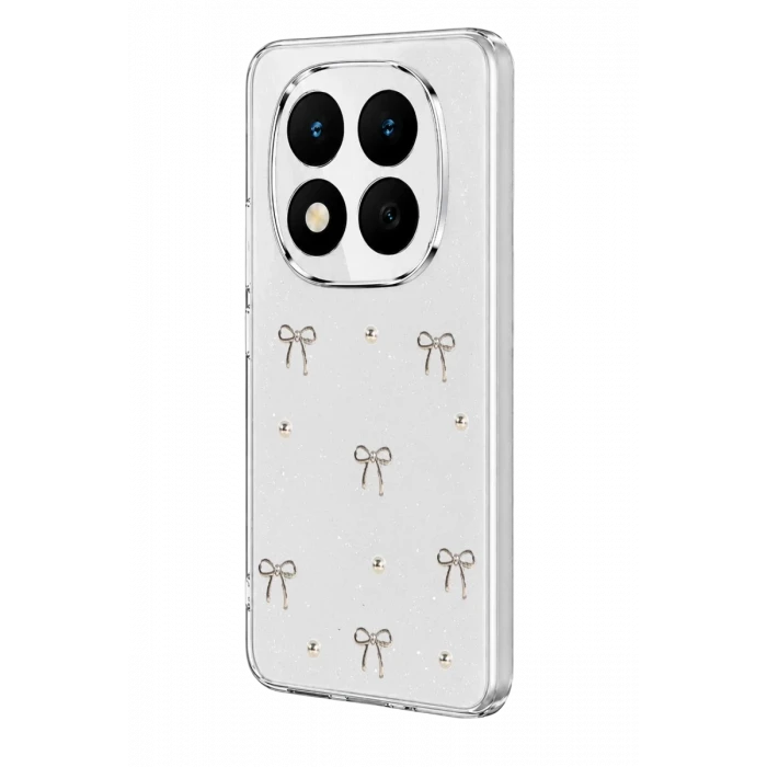 Newface Xiaomi Redmi Note 15 Pro Plus 5G Fiyonk Desenli Kapak - Desen 5