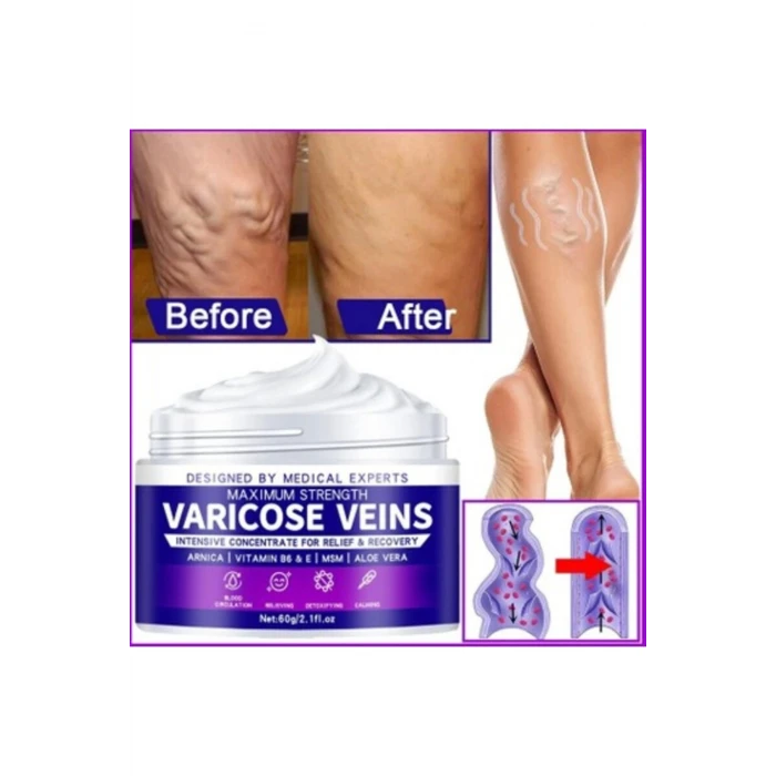 Strength Varicose Vein Tedavi Kremi 100 Ml X 2 ADET