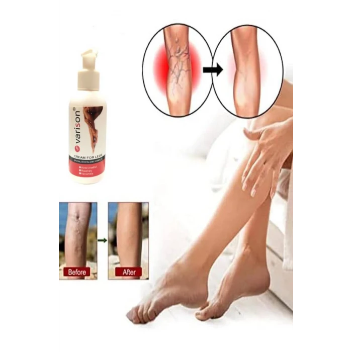 Varison Vari.s Sellülit Bacak Bakım Kremi 120 ml