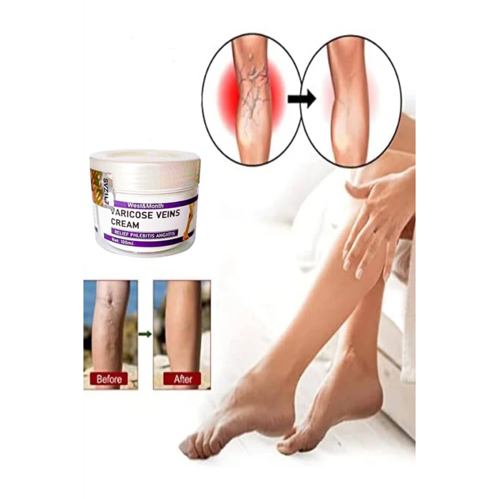 Varix Varicose Veins Purple Bakım Kremi 100 ml