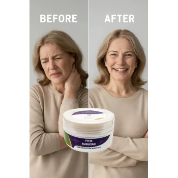 FITIK KURUTAN KREM 50 ML