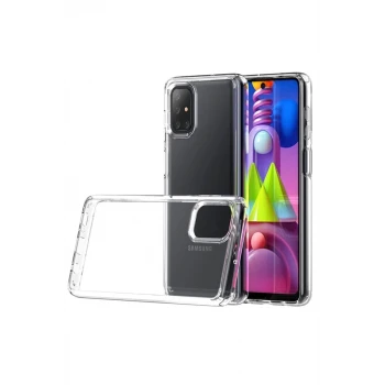 Newface Samsung Galaxy M51 Kılıf Lüx Şeffaf Silikon