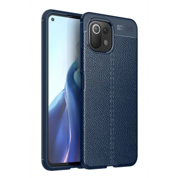 Newface Xiaomi Mİ 11 Lite Kılıf Auto Focus Kapak - Lacivert