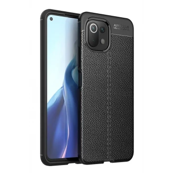 Newface Xiaomi Mİ 11 Lite Kılıf Auto Focus Kapak - Siyah