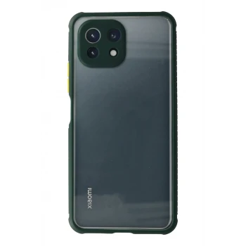 Newface Xiaomi Mİ 11 Lite Kılıf Miami Şeffaf Silikon - Koyu Yeşil