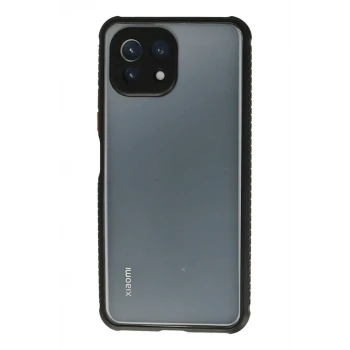 Newface Xiaomi Mİ 11 Lite Kılıf Miami Şeffaf Silikon - Siyah