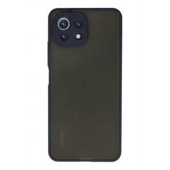 Newface Xiaomi Mİ 11 Lite Kılıf Montreal Silikon Kapak - Lacivert