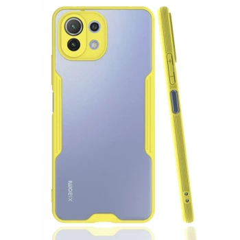 Newface Xiaomi Mİ 11 Lite Kılıf Platin Silikon - Sarı