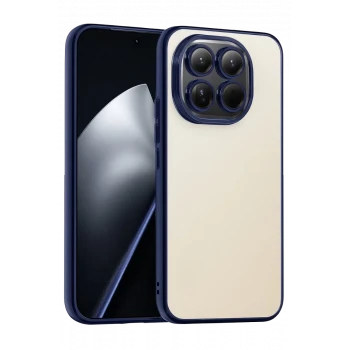 Newface Xiaomi Mi 15 Razer Lensli Silikon - Lacivert