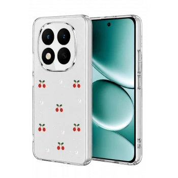 Newface Xiaomi Redmi Note 15 4G Fiyonk Desenli Kapak - Desen 9