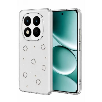 Newface Xiaomi Redmi Note 15 Pro 5G Fiyonk Desenli Kapak - Desen 2