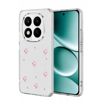 Newface Xiaomi Redmi Note 15 Pro Plus 5G Fiyonk Desenli Kapak - Desen 3