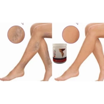 VARİSON VÜCUTKREMİ 200ML+50ML AYAKKREMİ