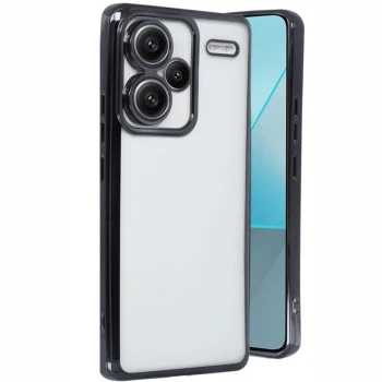 Xiaomi Redmi Note 13 Pro Plus Kılıf Razer Lensli Silikon - Siyah