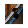 Newface Apple Watch 38mm Creeper Desenli Kordon - Gold