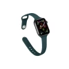 Newface Apple Watch 38mm Klasik Kordon - Haki Yeşil