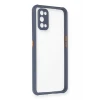Newface Realme 7 Pro Kılıf Miami Şeffaf Silikon - Gri
