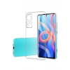 Newface Xiaomi Mi 12 Kılıf Lüx Şeffaf Silikon