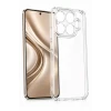 Newface Xiaomi Mi 17T Lüx Şeffaf Silikon - Şeffaf