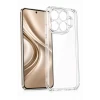 Newface Xiaomi Mi 17T Lüx Şeffaf Silikon - Şeffaf