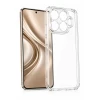 Newface Xiaomi Mi 17T Lüx Şeffaf Silikon - Şeffaf