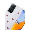 Newface Xiaomi Redmi Note 11 Pro Fiyonk Desenli Kapak - Desen 3